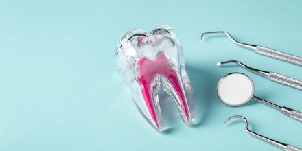 baisser-coût-soins-dentaires-2024