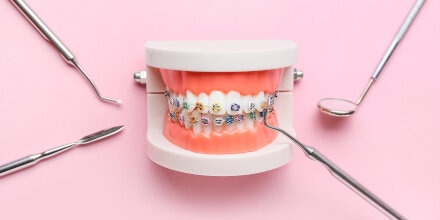 remboursement-prothèses-orthodontie-adulte